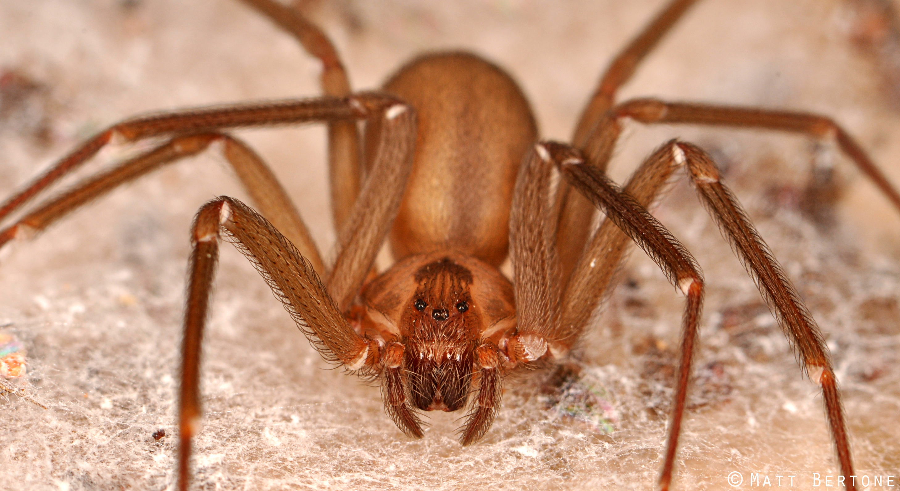 brown recluse spider bite