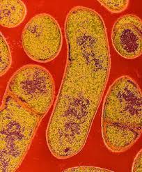 Cover photo for Botulism Poisoning From Home-Canned  Foods Is Rare but Serious and Deadly