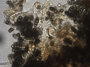 dark, multicelled spores of Thielaviopsis basicola, highly magnified