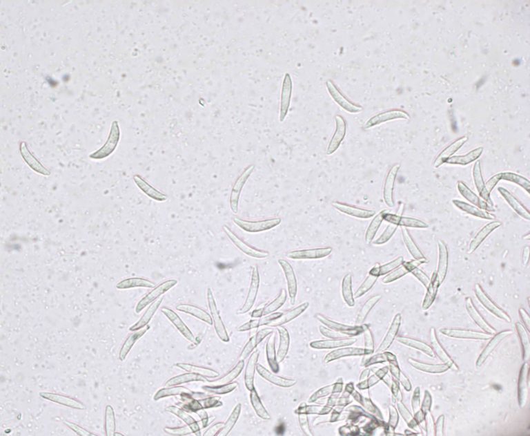 athracnose spores