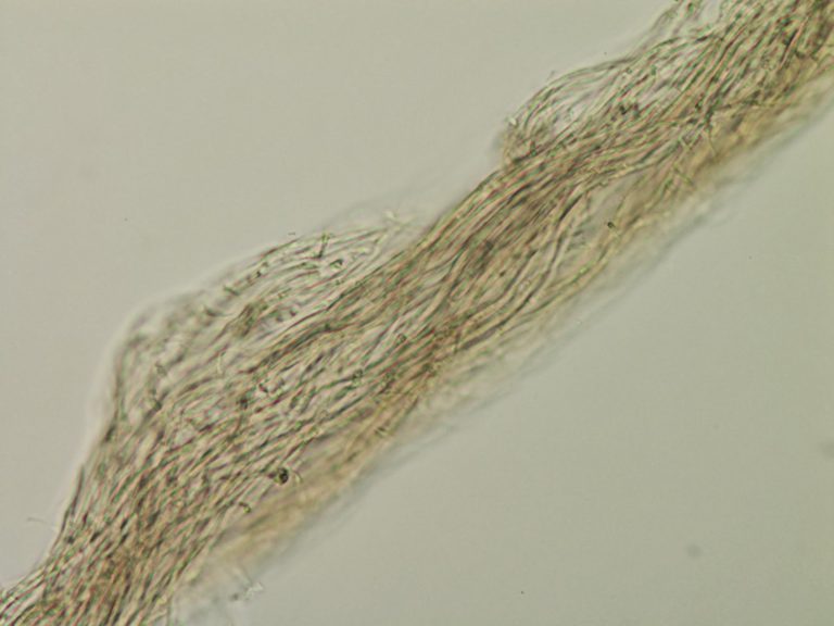 Close up of cream leaf blight hyphae twisting into a 