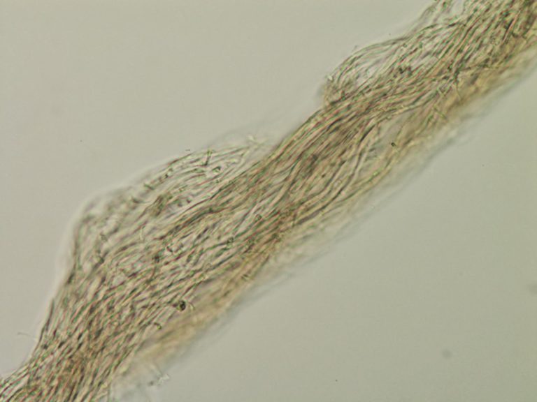 Close up of cream leaf blight hyphae twisting into a